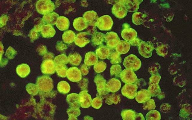 Кишечная палочка (escherichia coli), гкб, окб, ткб