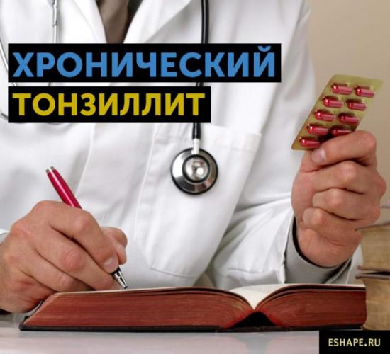 Хронический тонзиллит у взрослых: причины, формы течения, жалобы, диагностика, лечение и профилактика.