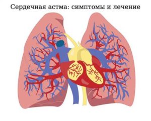 Откуда берётся одышка и когда она опасна