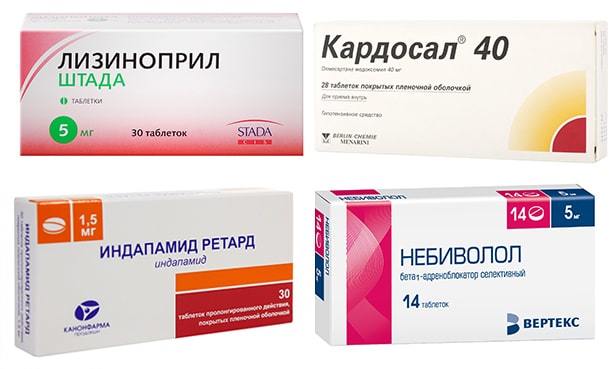 Почему возникает шум в ушах и как его лечить