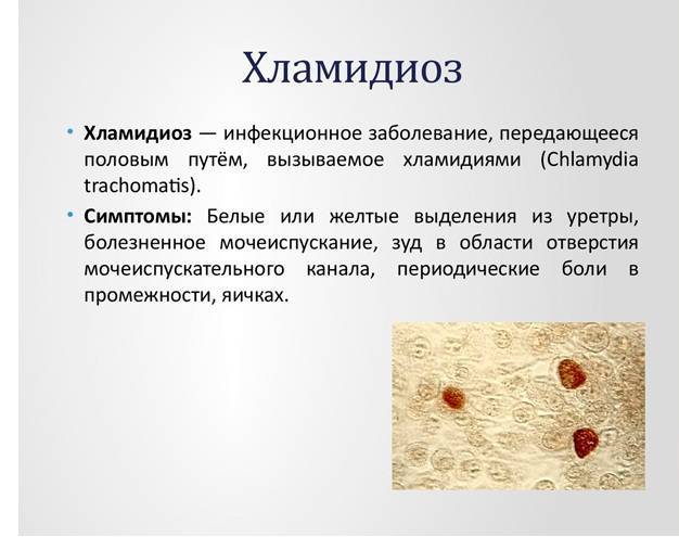 Хламидии