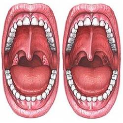 Лечение хронического тонзиллита дома, как лечить пробки в миндалинах в домашних условиях