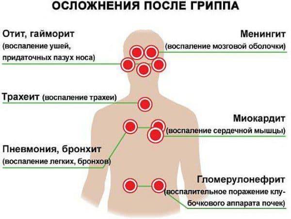 Противопоказания прививки от гриппа