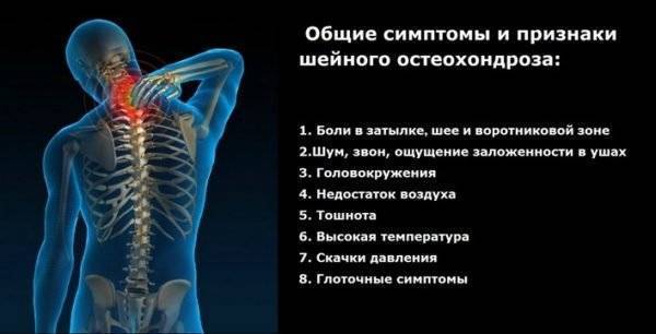 За что отвечает каждый позвонок шейного отдела позвоночника
