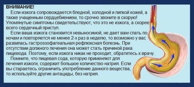 Изжога: почему возникает и как лечить