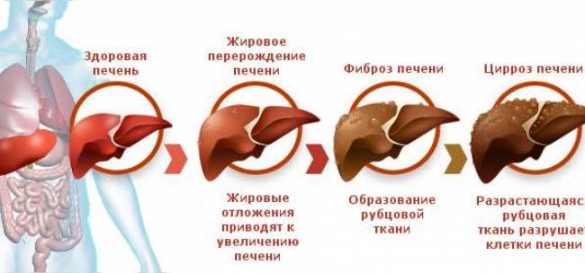 Диета при жидкости в брюшной полости