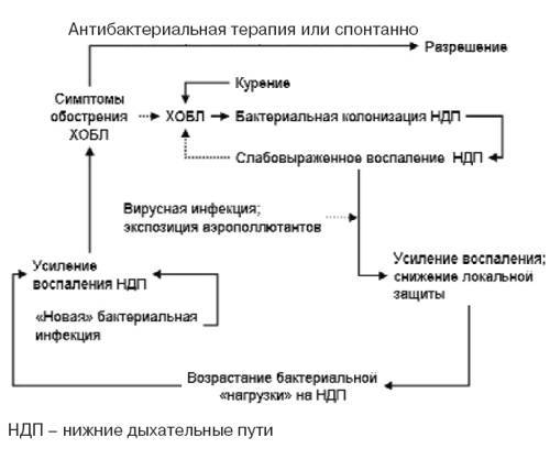 Хроническая обструктивная болезнь легких (хобл)