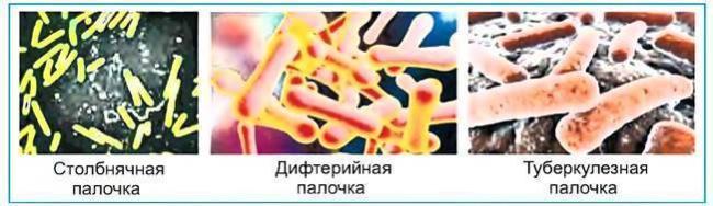 Плохие или хорошие: бактерии вокруг нас