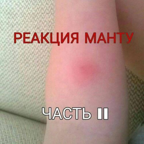 Можно ли сдавать кровь после прививки от гриппа и как это влияет на анализы