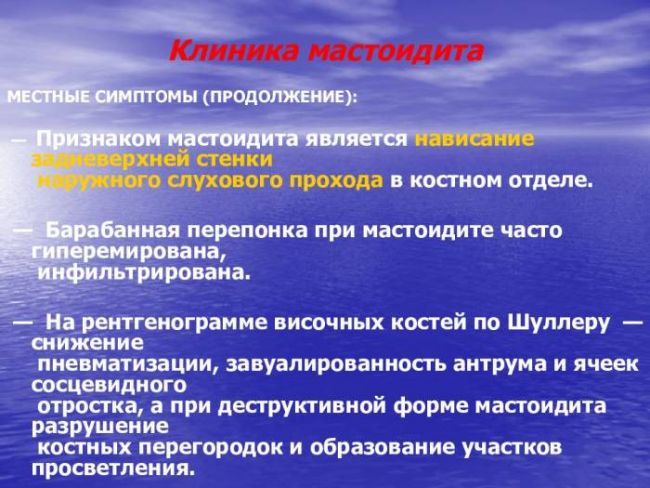 Мастоидит