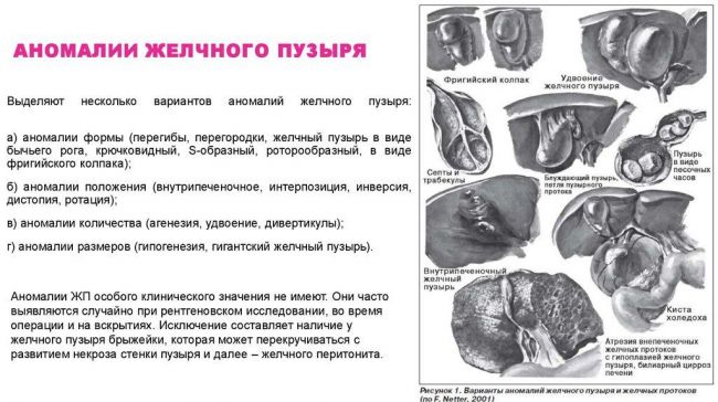 Продукты для желчного пузыря при застое желчи
