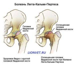 Болезнь пертеса у детей: как ее вылечить и предотвратить?