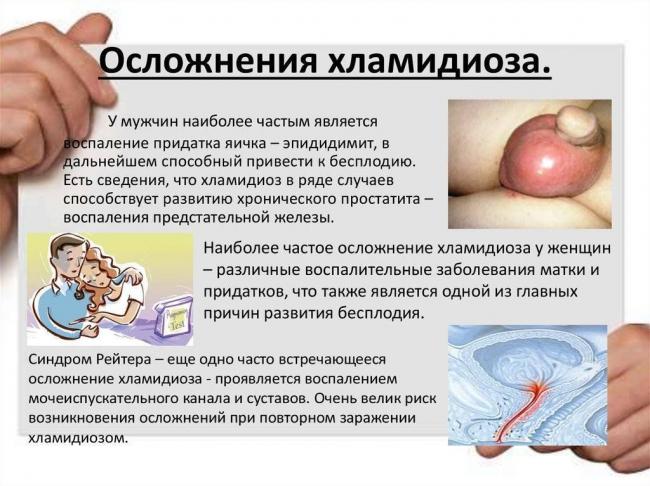 Хламидиоз (хламидийная инфекция)