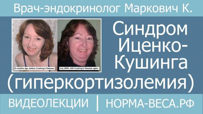 Вторичный гиперкортицизм или болезнь иценко-кушинга