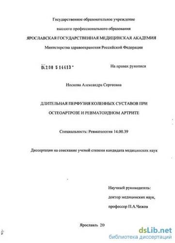 Что такое остеоартроз и остеоартрит?