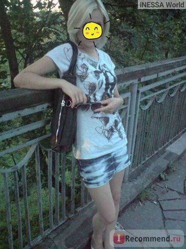 Что такое фиброаденома молочной железы, симптомы и причины заболевания