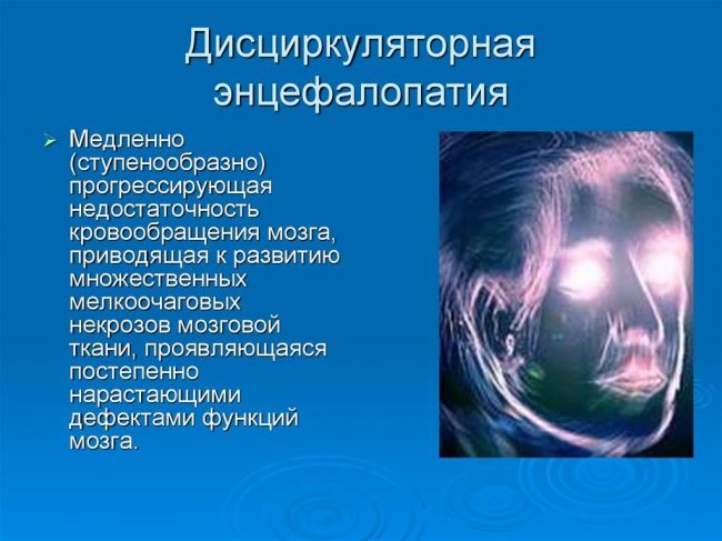 Резидуальная энцефалопатия: понятие, возникновение, симптомы, как лечить, прогноз