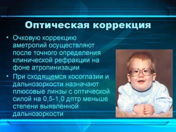 Косоглазие сходящиеся и его лечение