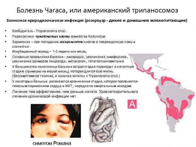 Сонная болезнь и болезнь шагаса (африканская и американская трипаносомы): жизненный цикл, симптомы, лечение
