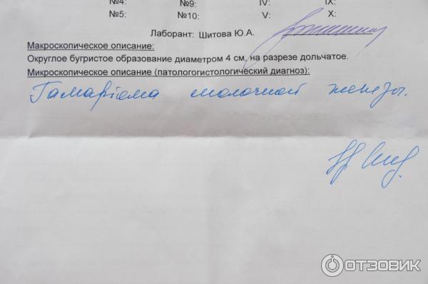 Фиброаденома молочной железы: симптомы