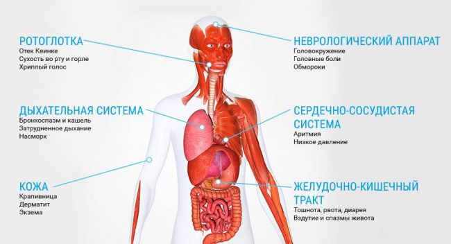Аллергия: причины, виды, симптомы, первая помощь и лечение