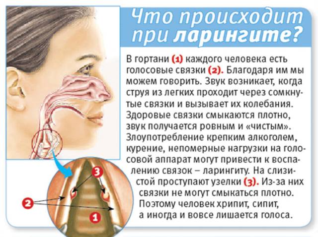 Болело горло потом пропал голос как лечить