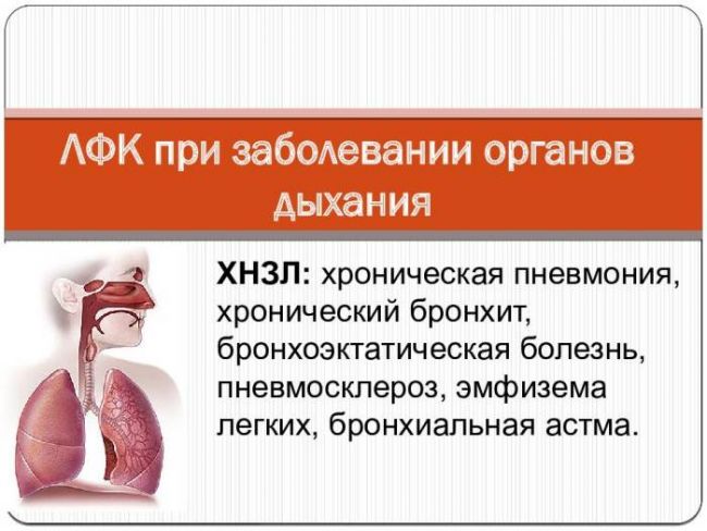 Массаж при пневмонии у детей: правила техники выполнения