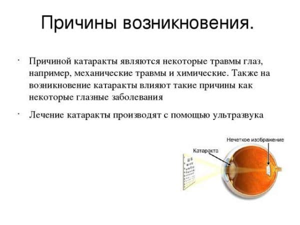 Бельмо на глазу у человека