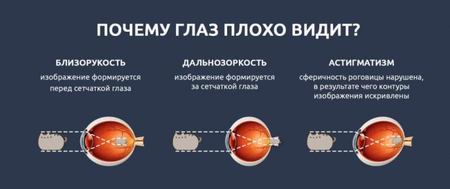 Миопия и очки тренажеры