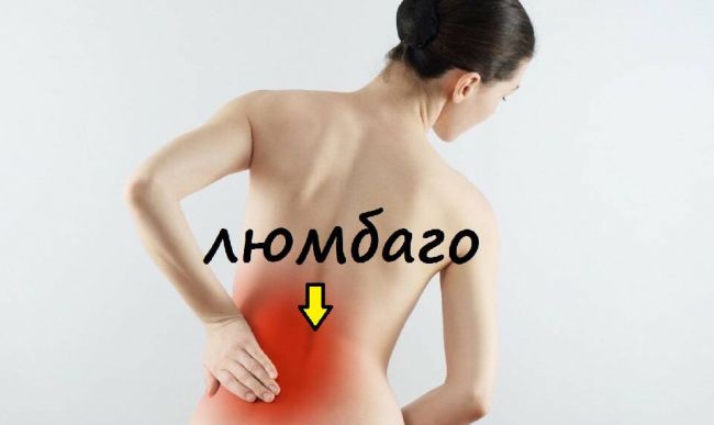 Симфизит при беременности