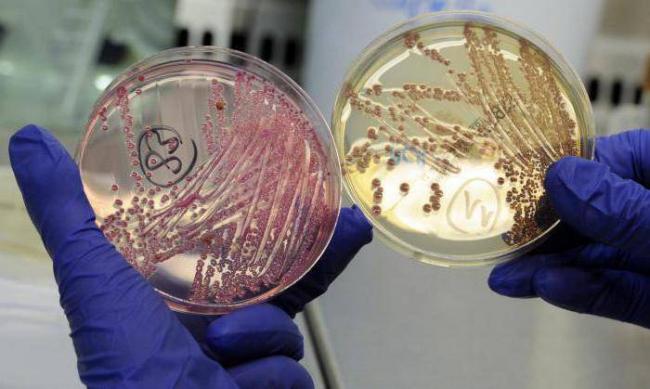 Кишечная палочка (escherichia coli), гкб, окб, ткб