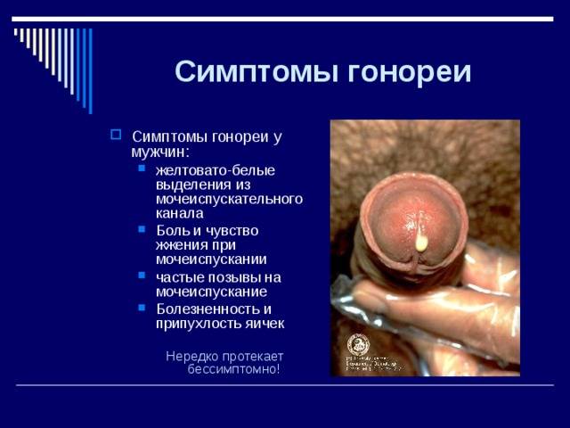 Причины стекловидных выделений у мужчин и нужно ли их лечить