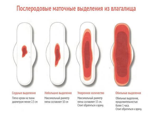 Выделения после кесарева сечения: сколько длятся / mama66.ru