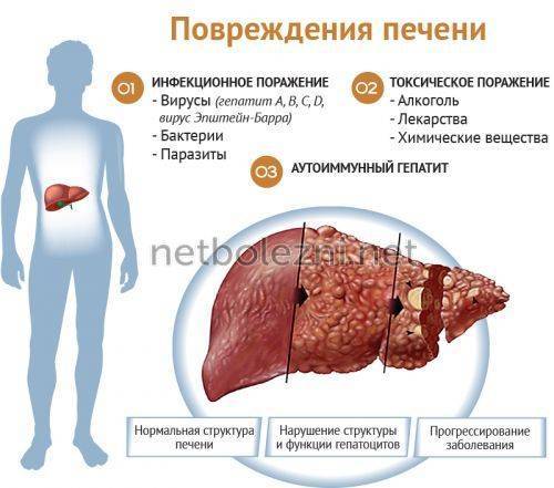 Лечение болячек в носу народными средствами