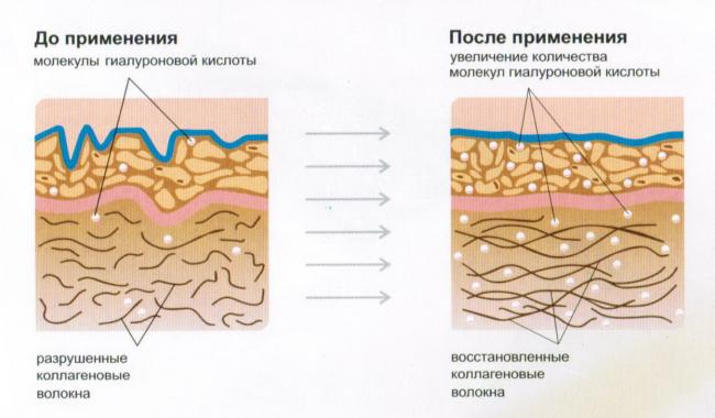 Уколы и свечи лонгидаза: инструкция, цена и отзывы