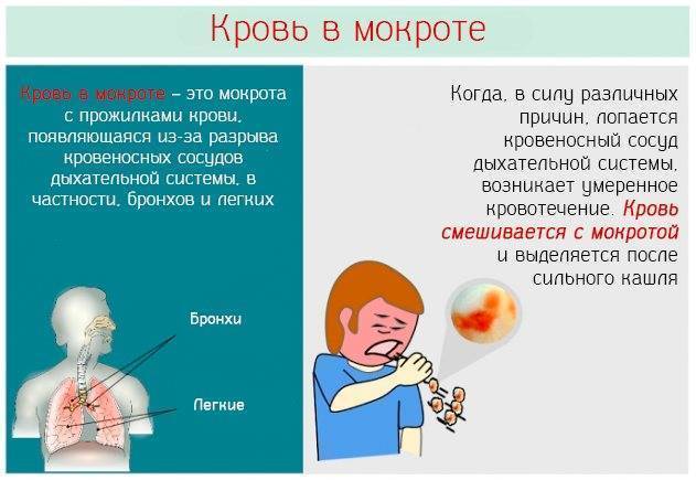 Почему при кашле появляется мокрота с кровью – связь с заболеваниями