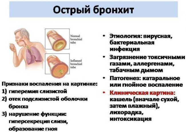 Лечение обструктивного бронхита у взрослых