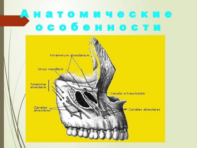 Верхнечелюстной синусит