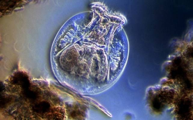 Кишечная палочка (escherichia coli), гкб, окб, ткб