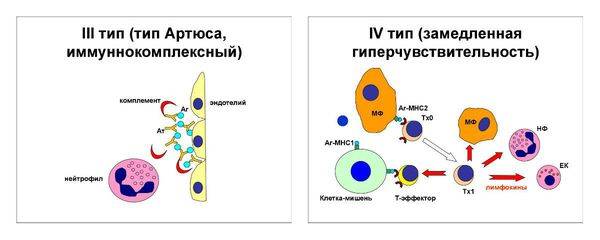 Токсико аллергический дерматит лечение