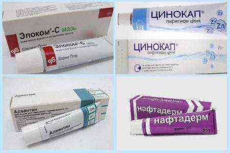 Себорея кожи головы у детей лечение
