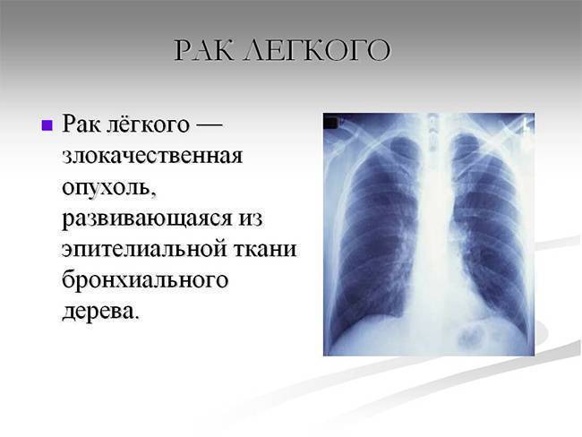 Кашель мокрота зеленого цвета с кровью