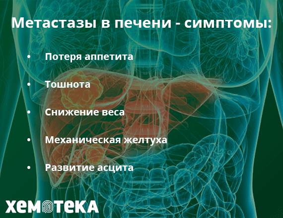 Эффективное лечение рака 4 стадии (метастазы, канцероматоз, асцит)
