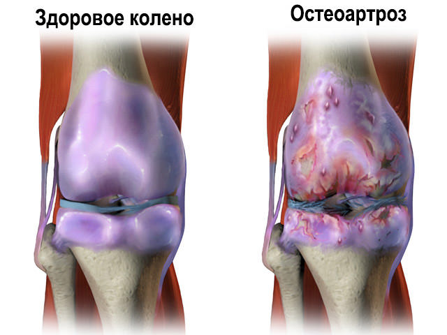 Бивалос: инструкция по применению