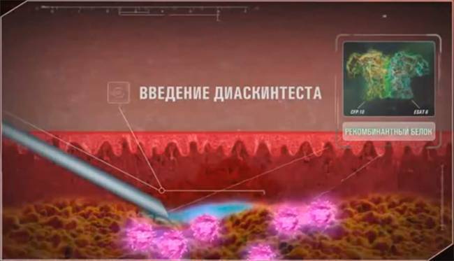 Через сколько после болезни можно делать манту