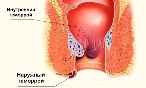 Фаст релиф