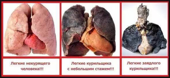 Как избавиться от кашля