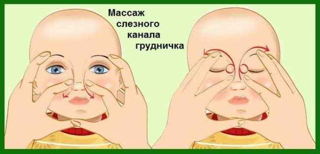 Гноятся глаза у ребенка чем лечить народными средствами
