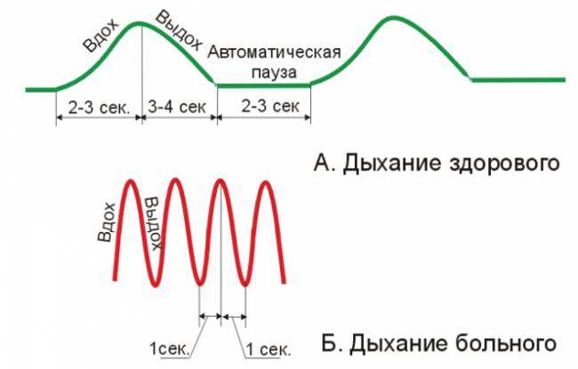 Дыхательная гимнастика бутейко при бронхиальной астме
