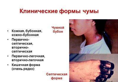 Воздействие микробов на пищевые продукты
